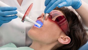 Thinking About Whitening Your Teeth? Here’s What to Expect
