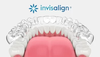 Could Invisalign Be the Clear Solution for Your Orthodontic Needs?